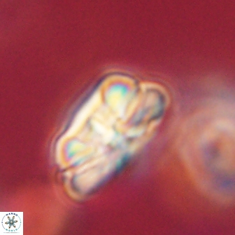 Heliolithus iptamenosdiskos 62266
