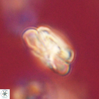 Heliolithus iptamenosdiskos 70501