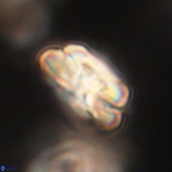 Heliolithus iptamenosdiskos 62271