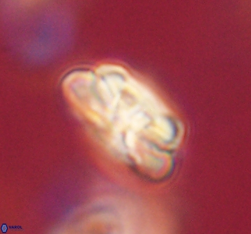 Heliolithus iptamenosdiskos 62272