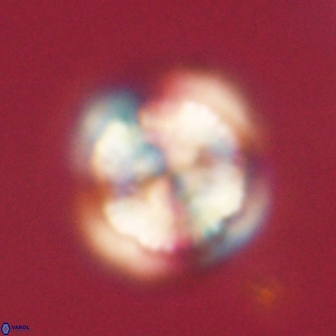 Heliolithus iptamenosdiskos 62276