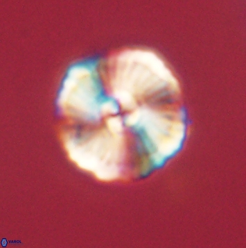 Heliolithus iptamenosdiskos 62278