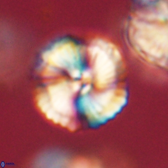 Heliolithus iptamenosdiskos 62282