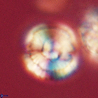 Heliolithus iptamenosdiskos 62283