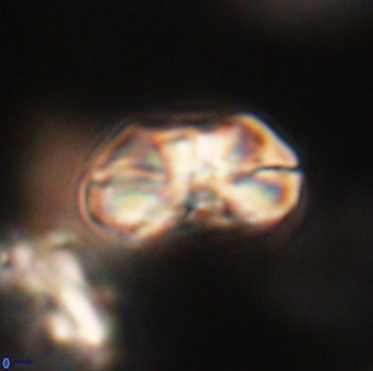 Heliolithus iptamenosdiskos 63150