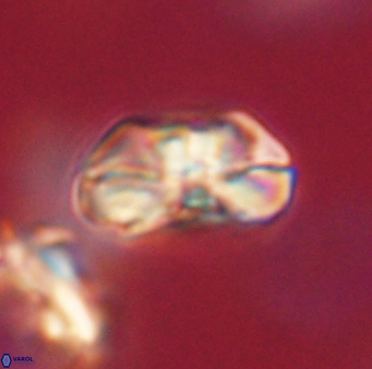 Heliolithus iptamenosdiskos 63151