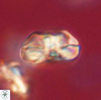 Heliolithus iptamenosdiskos 63151