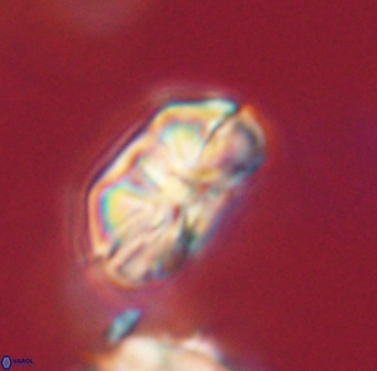 Heliolithus iptamenosdiskos 63152