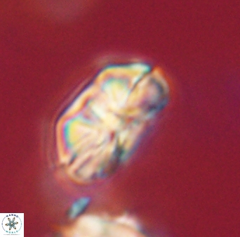 Heliolithus iptamenosdiskos 63152