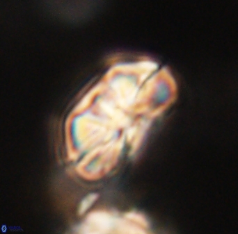 Heliolithus iptamenosdiskos 63153