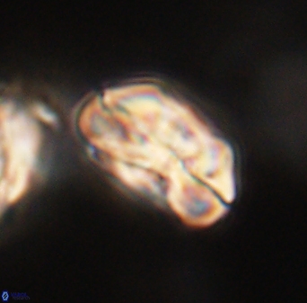 Heliolithus iptamenosdiskos 63154