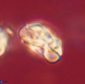 Heliolithus iptamenosdiskos 63155