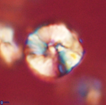 Heliolithus iptamenosdiskos 63156