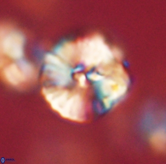 Heliolithus iptamenosdiskos 63160