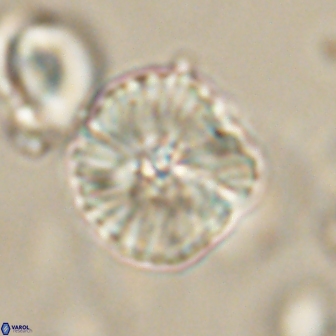 Heliolithus iptamenosdiskos 63161