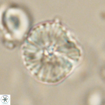 Heliolithus iptamenosdiskos 63161