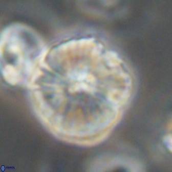 Heliolithus iptamenosdiskos 63162