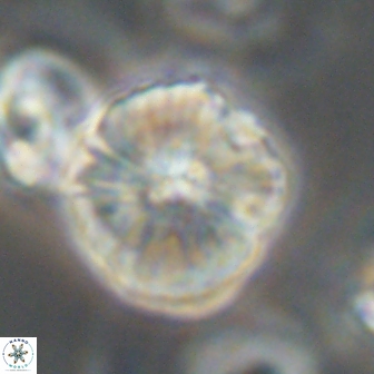 Heliolithus iptamenosdiskos 63162