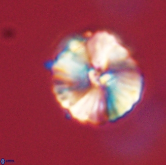 Heliolithus iptamenosdiskos 63168