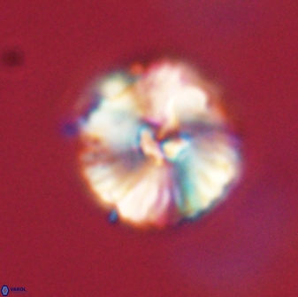 Heliolithus iptamenosdiskos 63170