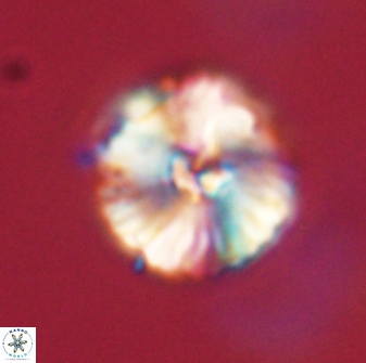 Heliolithus iptamenosdiskos 63170