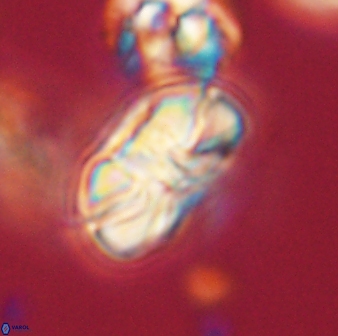 Heliolithus iptamenosdiskos 63173