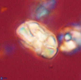 Heliolithus iptamenosdiskos 63181