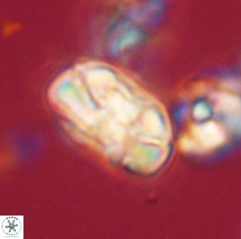 Heliolithus iptamenosdiskos 63181