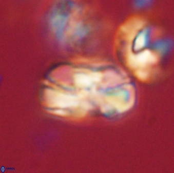 Heliolithus iptamenosdiskos 63182