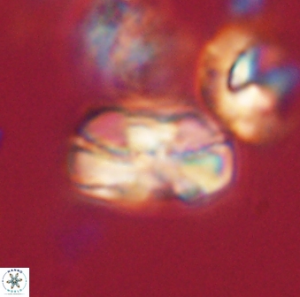Heliolithus iptamenosdiskos 63182