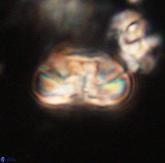 Heliolithus iptamenosdiskos 63185