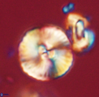 Heliolithus iptamenosdiskos 63187