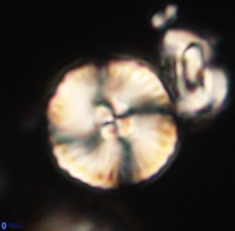 Heliolithus iptamenosdiskos 63188