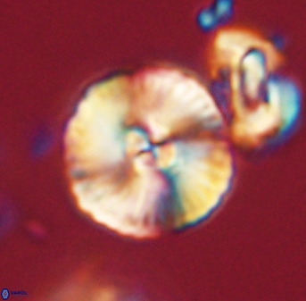 Heliolithus iptamenosdiskos 63190