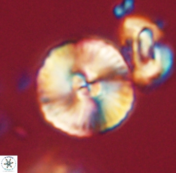 Heliolithus iptamenosdiskos 63190