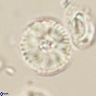 Heliolithus iptamenosdiskos 63191