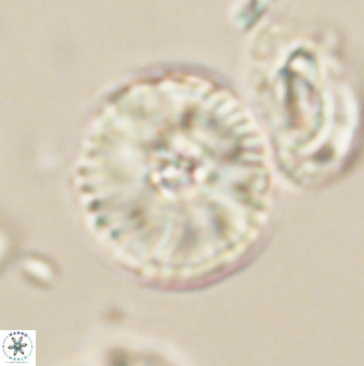 Heliolithus iptamenosdiskos 63191