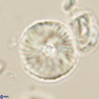 Heliolithus iptamenosdiskos 63192