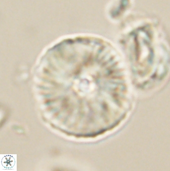 Heliolithus iptamenosdiskos 63192