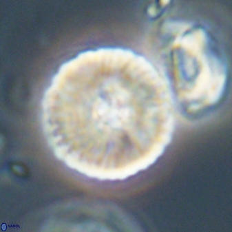 Heliolithus iptamenosdiskos 63193