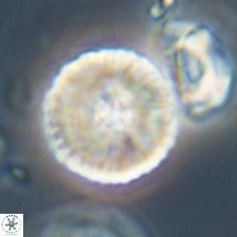 Heliolithus iptamenosdiskos 63193