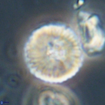 Heliolithus iptamenosdiskos 63194