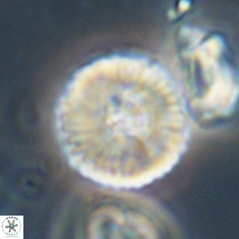 Heliolithus iptamenosdiskos 63194
