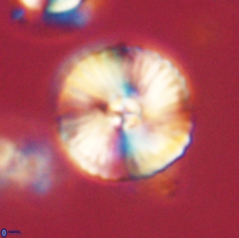 Heliolithus iptamenosdiskos 63197