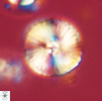 Heliolithus iptamenosdiskos 63197