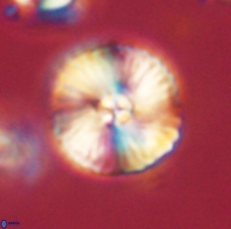 Heliolithus iptamenosdiskos 63200