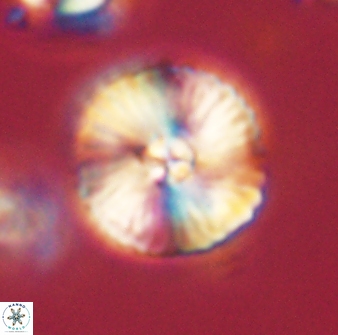 Heliolithus iptamenosdiskos 63200