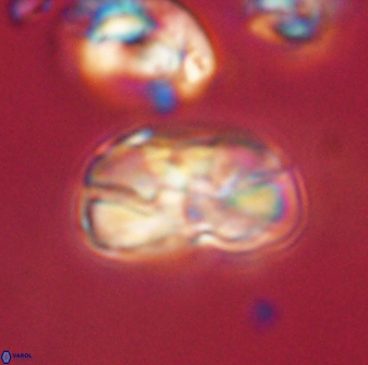 Heliolithus iptamenosdiskos 63201