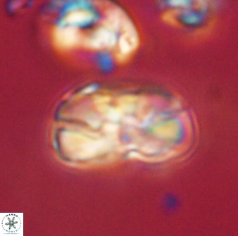 Heliolithus iptamenosdiskos 63201