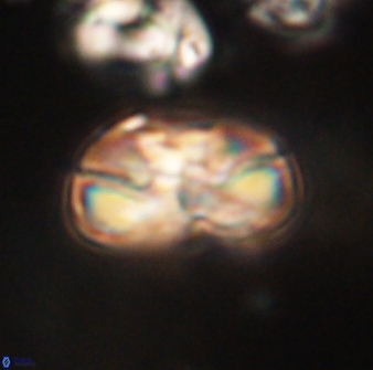 Heliolithus iptamenosdiskos 63202